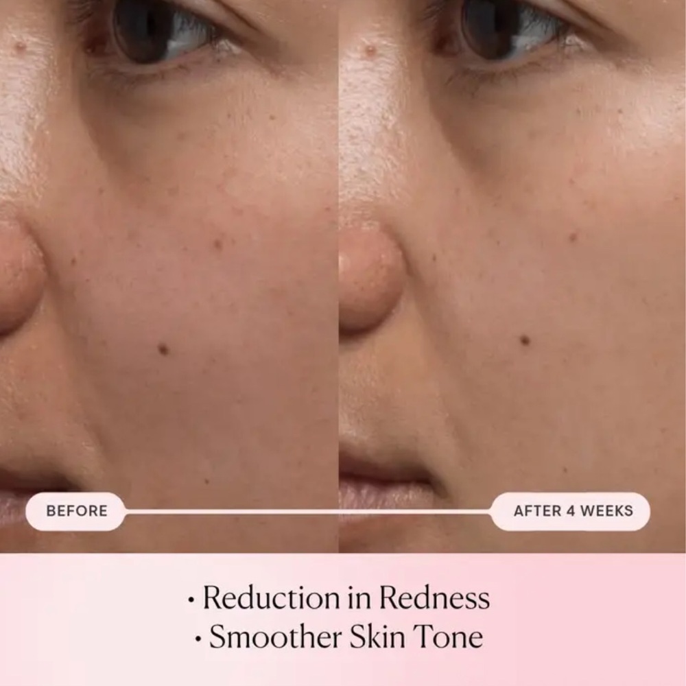 🌸 ELEMIS PRO-COLLAGEN ROSE MICRO SERUM - Picture 5 of 13